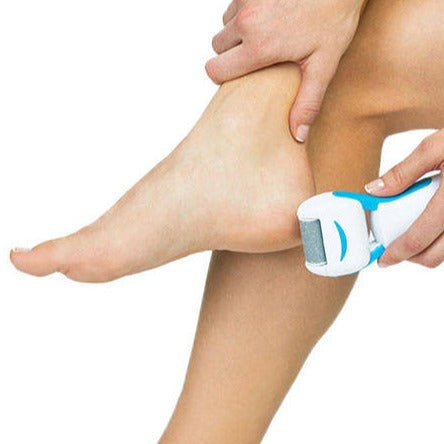 REMOVEDOR DE CALOS ELÉCTRICO PARA OS PÉS - PEDEGG™
