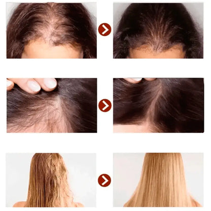 CONDICIONADOR ANTI-QUEDA DE CABELO PARA HOMENS E MULHERES - JANTAR NUTRI-REPAIR™