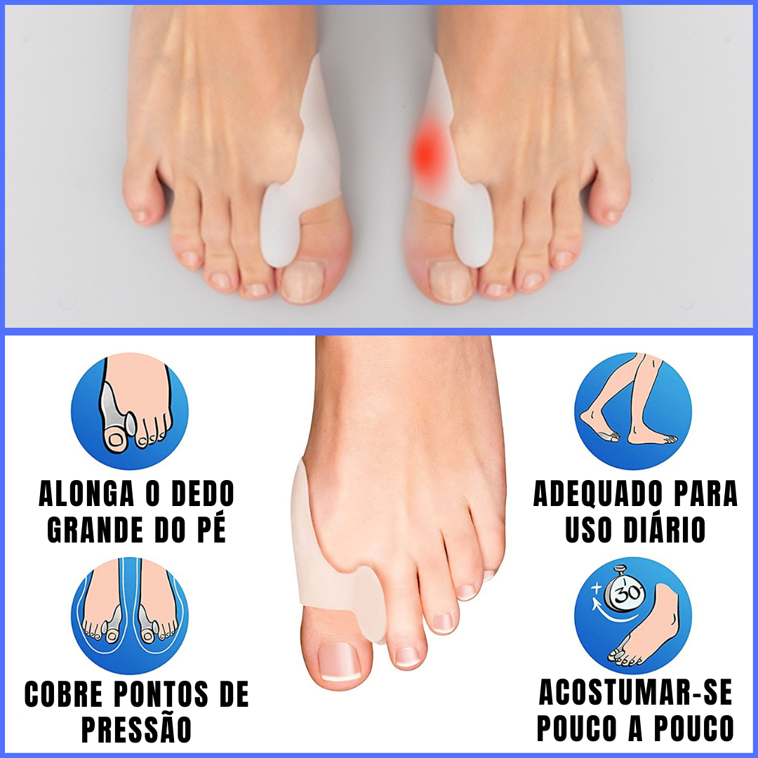 CORRETOR-PROTETOR DE SILICONE PARA JOANETES PACK DE 2 UDS - HAPPYFEET™