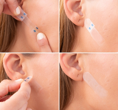 ADESIVOS DE LEVANTAMENTO FACIAL EFEITO LIFTING - FACELIFT™