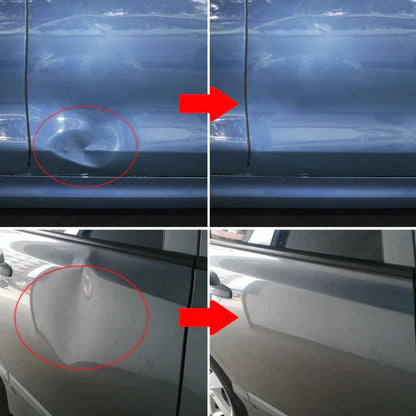 KIT DE REMOÇÃO DE AMOLGADELAS PARA VEÍCULOS  - CARPLUS™