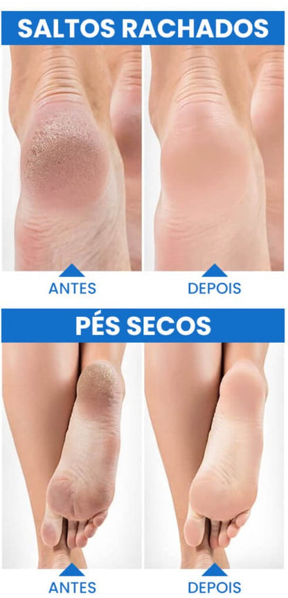 MEIAS DE GEL HIDRATANTE COM ÓLEOS NATURAIS PARA CALCANHAR - SOFTPEEL™