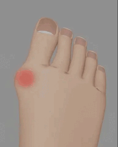 MEIAS RELAXANTES PARA OS PÉS - SOCK RELAX TOES™