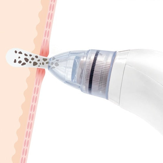 APARELHO DE LIMPEZA FACIAL ELÉTRICO PARA PONTOS NEGROS - POREOFF™