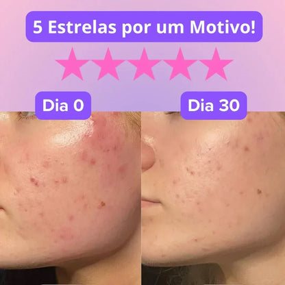 LUMY™ - Máscara Rejuvenescedora efeito anti-rugas